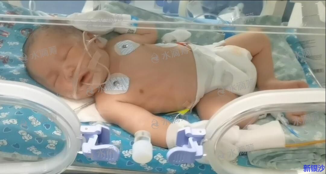 广东湛江新生宝宝重症抢救，妈妈难产去世，爸爸绝望求助。